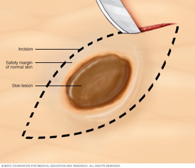 pink vaginal bleeding social thumbs